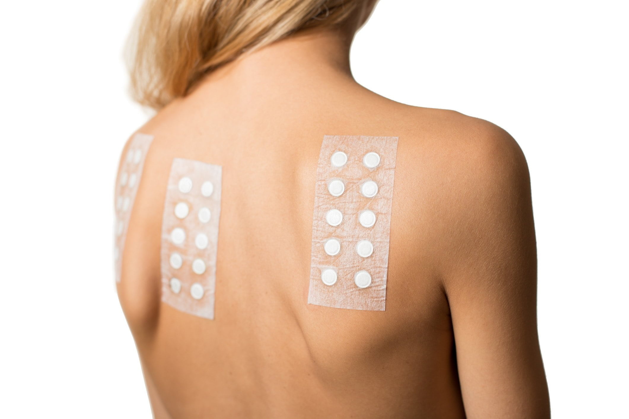 Allergy Patch Test Allergy Patch Test