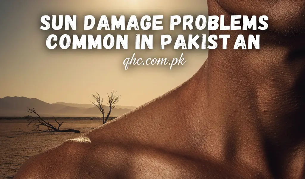 Sun Damage Problems Common in Pakistan