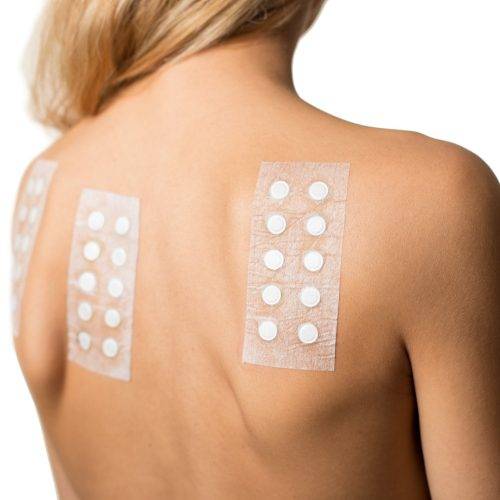 Allergy Patch Test